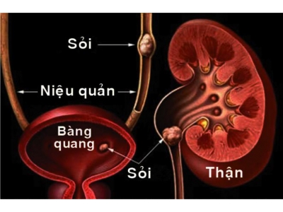 Nguồn nước bị ô nhiễm gây hại gì con người?