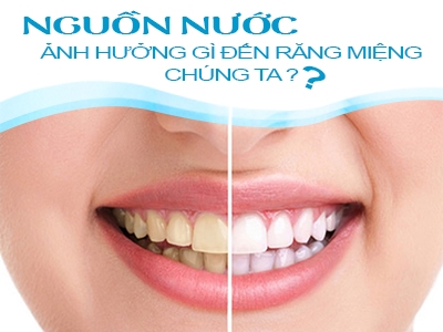 Nước uống bẩn - Nguyên nhân trực tiếp gây ra các bệnh nha chu